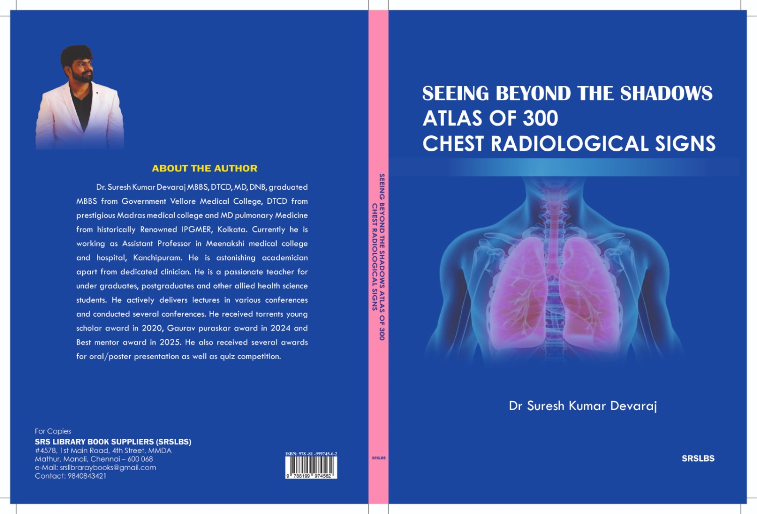 Seeing Beyond The Shadows Atlas Of 300 Chest Radiological Signs 1Ed 2026
